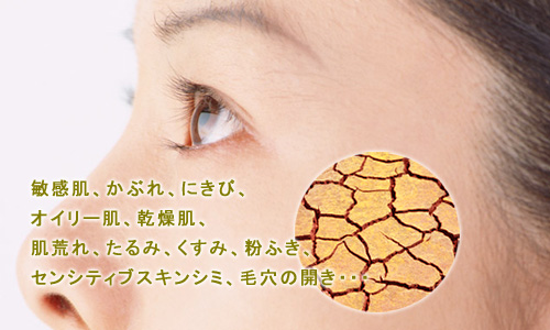 敏感肌、かぶれ、肌荒れ、粉ふき、センシティブスキン、親肌の悩み